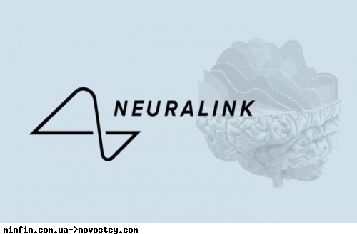 Neuralink Ілона Маска отримав $650 мільйонів від інвесторів