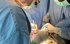 Лікарі вперше встановили протез мітрального клапана в серце під час його биття